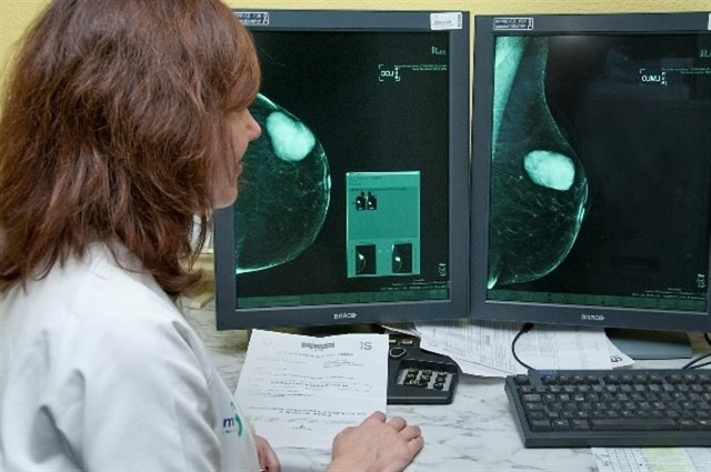 341 mujeres de Fuentes de León se someterán a mamografías a partir de mañana