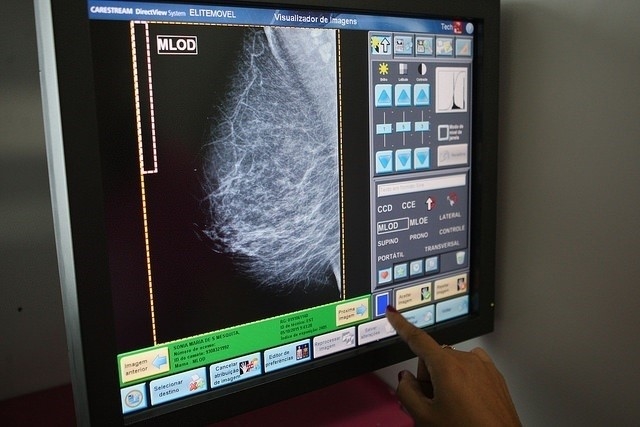 935 mujeres de Cabeza la Vaca, Bodonal y Fregenal se someterán a mamografías este mes de julio