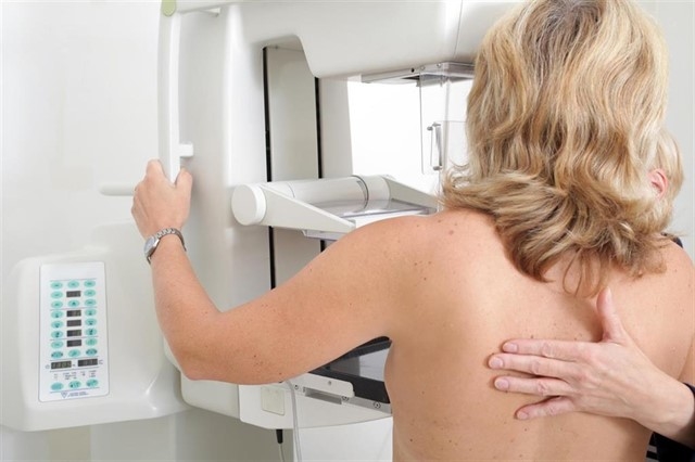 589 mujeres de Segura de León e Higuera la Real se someterán a mamografías este mes de septiembre