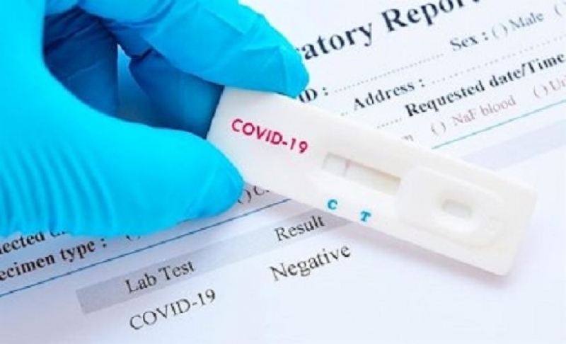 Higuera, Fregenal y Cabeza la Vaca también alertan sobre el fraude de los test COVID-19 por las casas